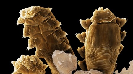 Tu cara está repleta de estos bichos microscópicos que no tienen ano