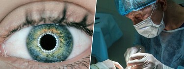 Sem lasers e sem cortes: a técnica que promete aposentar os óculos em 1 minuto