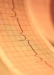 Regenerando miocardio tras un infarto