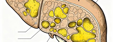 Cientistas usam nanotecnologia contra a gordura no fígado e conseguem resultados promissores com "drones de RNA" para desativar "gene do mal" 