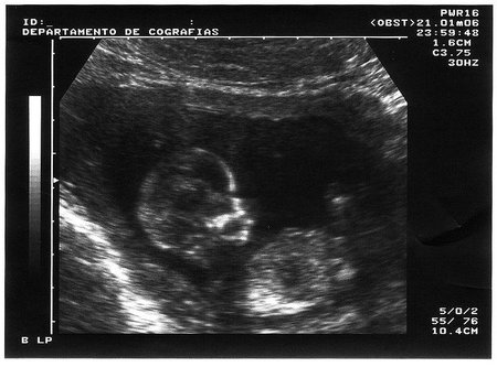 Resumen de la semana del 13 al 19 de octubre en Peques y Más