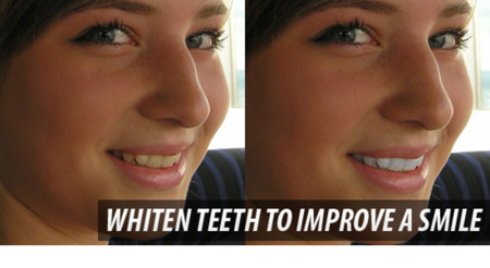 12 19 Whiten Teeth To Improve A Smile In Photoshop Cs4
