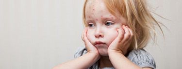 Alerta de sarampión en Europa: cuáles son los países más afectados