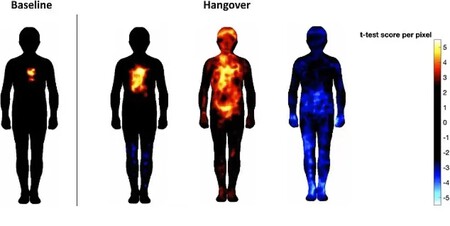 Pain Map