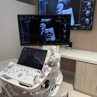 Samsung ya está en los hospitales españoles: así está cambiando el diagnóstico médico con IA 