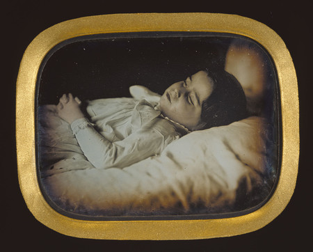 Carl Durheim Postmortem Of A Child Getty 64235