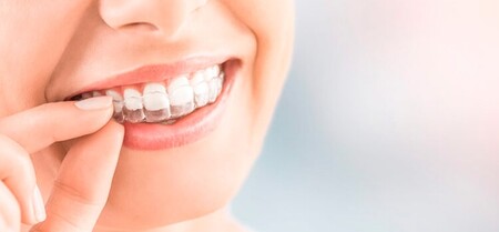 Invisalign en adolescentes: cuándo se recomienda y qué debes saber si tu hijo va a comenzar un tratamiento de ortodoncia invisible