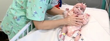 Con solo dos meses Naiara es la primera bebé en recibir un trasplante de corazón en parada y de un grupo sanguíneo incompatible