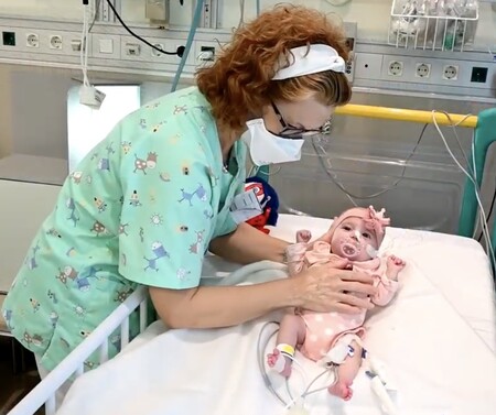 Con solo dos meses Naiara es la primera bebé en recibir un trasplante de corazón en parada y de un grupo sanguíneo incompatible
