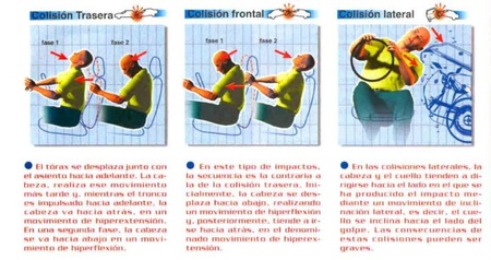 Movimientos de cabeza en caso de impacto