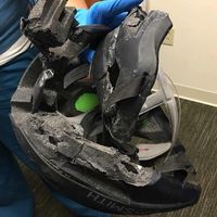 La impactante fotografía y mensaje de una pediatra, que muestra la importancia de que los niños lleven casco siempre