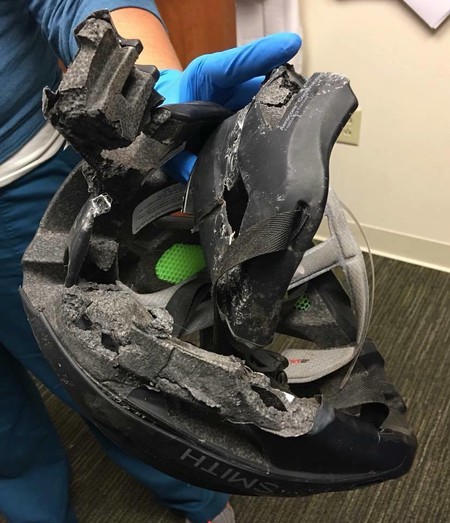 La impactante fotografía y mensaje de una pediatra, que muestra la importancia de que los niños lleven casco siempre