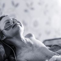 Un padre comparte la cruda imagen de su hija con cáncer, días antes de morir