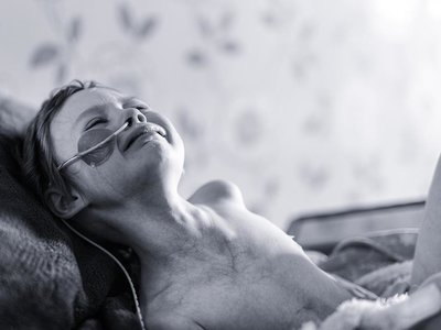 Un padre comparte la cruda imagen de su hija con cáncer, días antes de morir