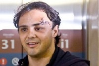 Felipe Massa estará lejos de los circuitos hasta 2010