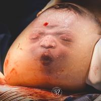 La espectacular fotografía ganadora de un bebé nacido dentro de la bolsa amniótica 