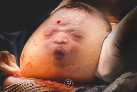 La espectacular fotografía ganadora de un bebé nacido dentro de la bolsa amniótica