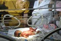 El sulfato de magnesio para el tratamiento del bebé prematuro