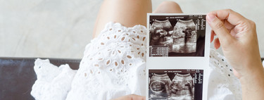 Pruebas en el embarazo: la medición del pliegue nucal