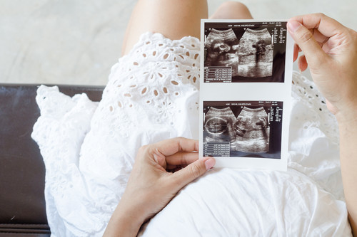 Pruebas en el embarazo: la medición del pliegue nucal