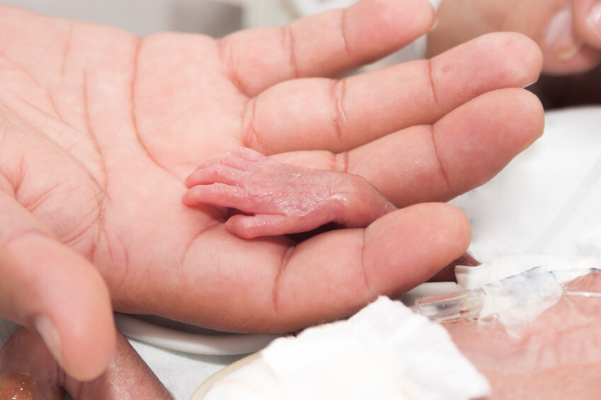 Dan Por Muerto A Un Bebe Nacido Prematuro Con 23 Semanas Y Horas Despues Descubren Que Estaba Vivo
