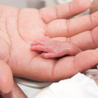 Dan por muerto a un bebé nacido prematuro con 23 semanas y horas después descubren que estaba vivo 