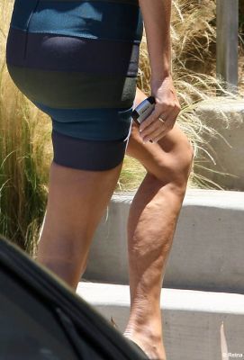 La celulitis de Victoria Beckham