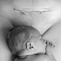 La sincera y cruda respuesta de una mujer a la que dijeron que su cesárea fue "el camino fácil"