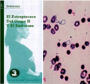 Folleto informativo sobre la infección por estreptococo B y embarazo