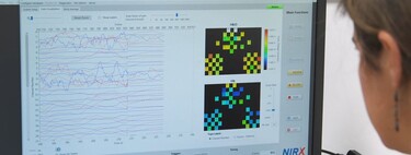 Por primera vez, la neuroimagen muestra los cambios que se producen en el cerebro de los niños cuando juegan con muñecas