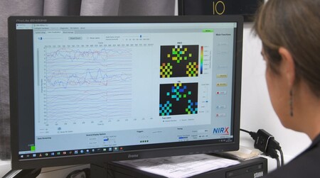Por primera vez, la neuroimagen muestra los cambios que se producen en el cerebro de los niños cuando juegan con muñecas