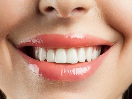 Si quieres una sonrisa perfecta restringe el consumo de estos alimentos