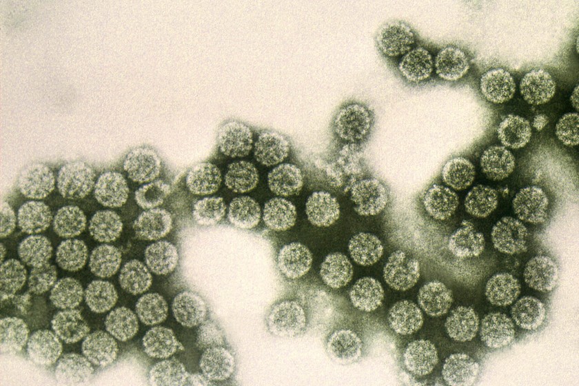 La crisis de la listeriosis y la