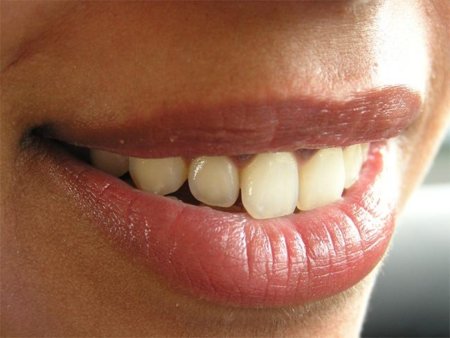 Los problemas de dientes en los deportistas