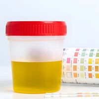 El mundo busca fertilizantes más baratos y sostenibles, y la respuesta podría estar en el baño