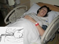 Posibles intervenciones rutinarias en el parto hospitalario: la amnioscopia