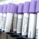 Influencia de la vitamina B y determinados genes sobre el embarazo in vitro