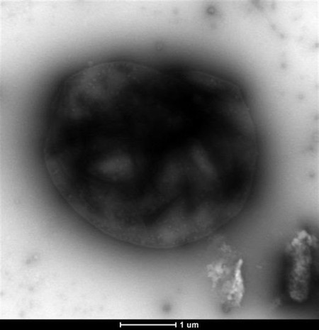 El metano se convierte en electricidad gracias a estas bacterias