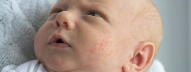 La piel del bebé y niño: guía de la A a la Z de las peculiaridades, cuidados y patologías más frecuentes en la infancia 