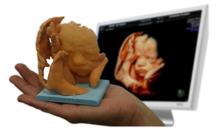 Baby3Dprint: una escultura del feto a partir de la ecografía, ¿la querrías?