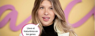 El último retoque estético de Anita Matamoros: este es su nuevo rostro tras pasar por boxes 