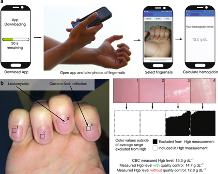 App Anemia