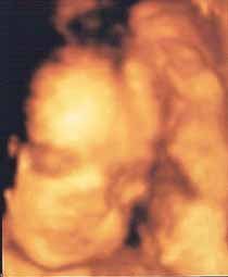 La foto de tu bebé: 24 semanas en el vientre de mamá