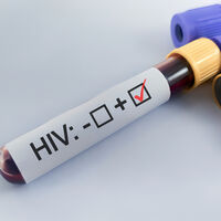 Descoberta histórica pode ser início do fim do HIV: cientistas alemães encontram anticorpo capaz de neutralizar quase todas as variantes do vírus 