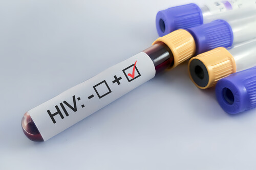 Frasco de sangue de HUV. Créditos:	Fania Witardiana/GettyImages