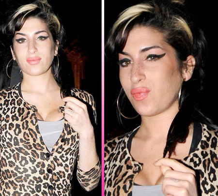 Amy Winehouse ahora es adicta a la cirugía