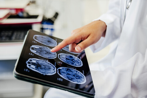 tablet com imagens cerebrais