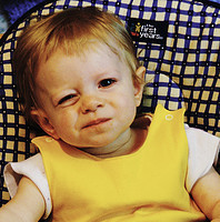 Mi bebé tiene reflujo gastroesofágico