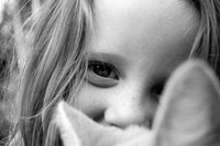 Ojeras en los niños