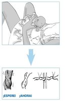 Beneficios del pinzamiento tardío del cordón